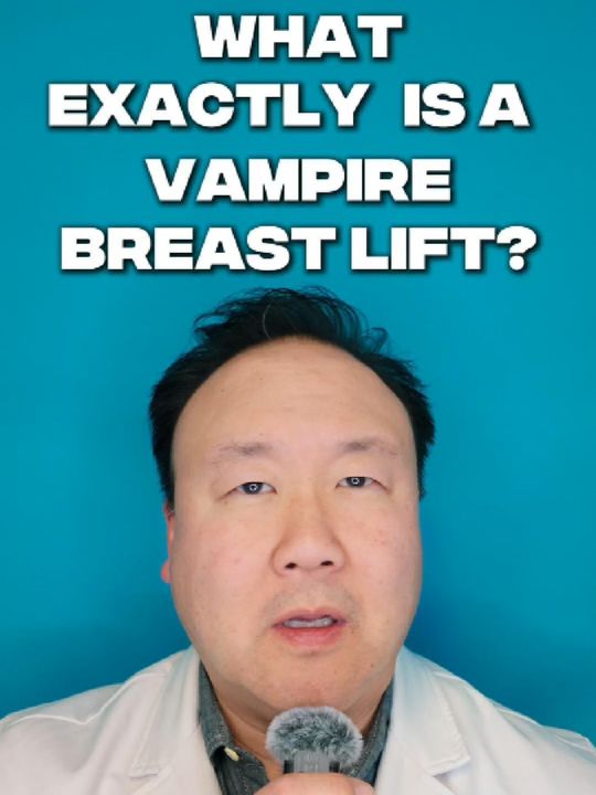 Video by Dr. Roy Kim: 🩸 Would YOU Try a Vampire Breast Lift? 👀💉 🔍 What it is: A non-surgical PRP (Platelet-Rich Pla…