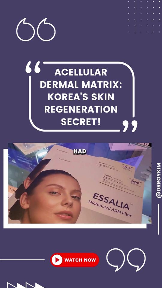 Video by Dr. Roy Kim: 💥NEW SKIN TECH FROM KOREA Ever heard of ADM—Acellular Dermal Matrix? 👩‍⚕️ Used in breast recon…