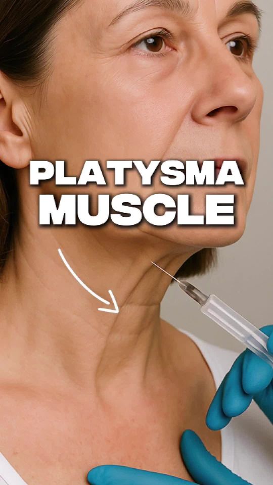 Video by Dr. Roy Kim: 👀 Noticing neck bands? Let’s talk platysma! ✨ Botox can relax the muscles for smoother skin 🔪 S…