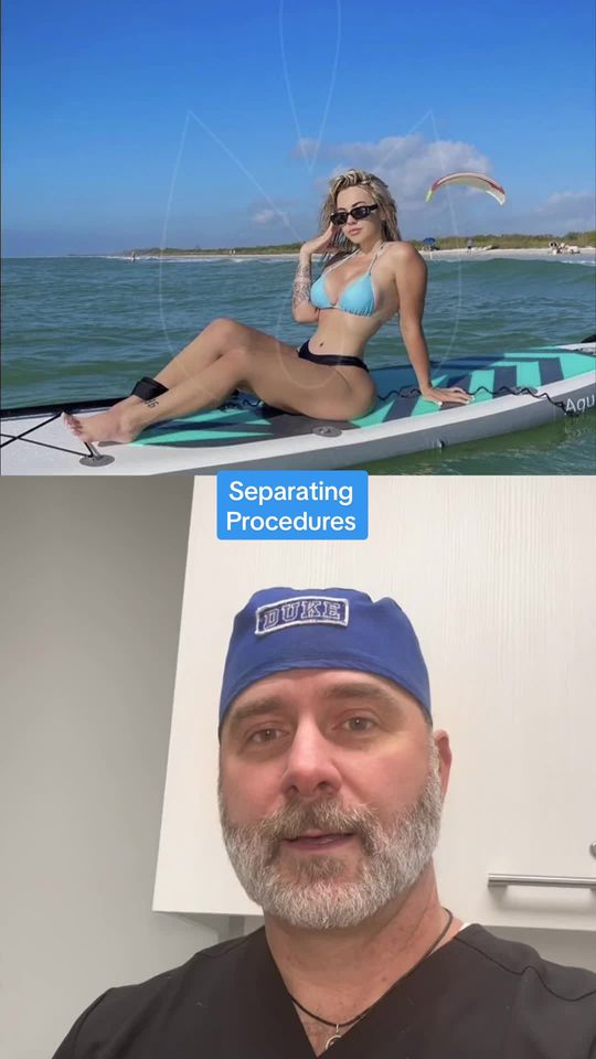 Video by Dr. S. Alexander Earle: Seperating procedures for long lasting results🤙🏼 # # # # # # # # # #