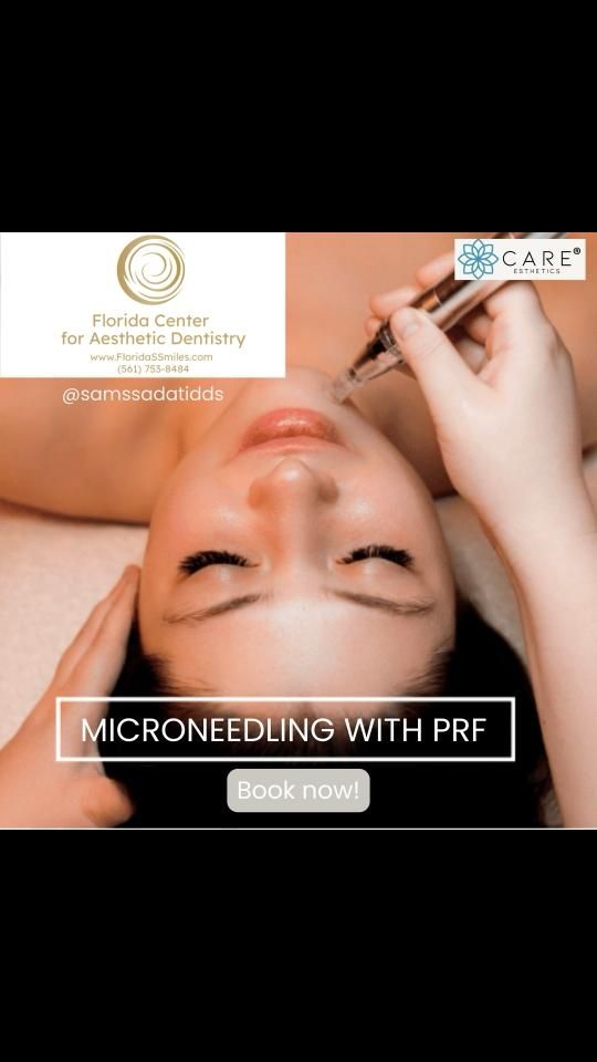 Video by Dr. Sam S. Sadati: Want flawless, glowing skin? At Dr. Sam Sadati's office, we're combining microneedling with PRF,…
