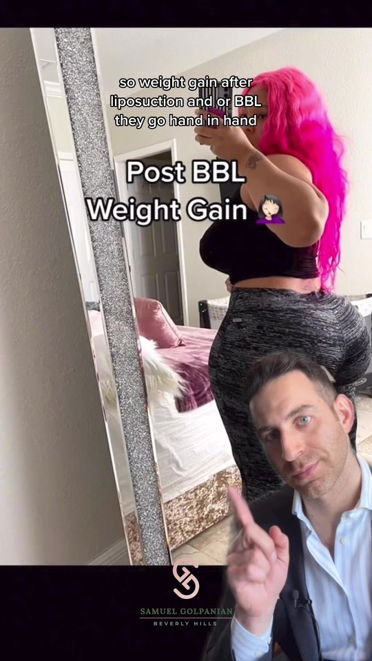 Video by Dr. Samuel Golpanian: WEIGHT GAIN AFTER LIPOSUCTION: Here’s the breakdown ^