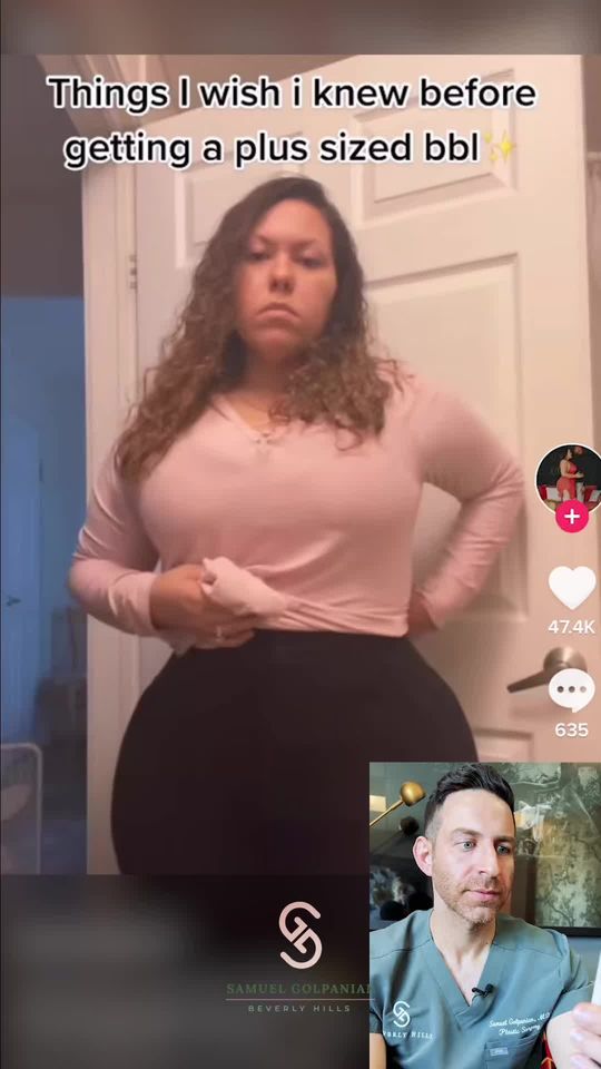 Video by Dr. Samuel Golpanian: @platinumbarbi FIBROSIS POST BBL: EXPLAINED! Lymphatic Massages post BBL help maximize your resul…