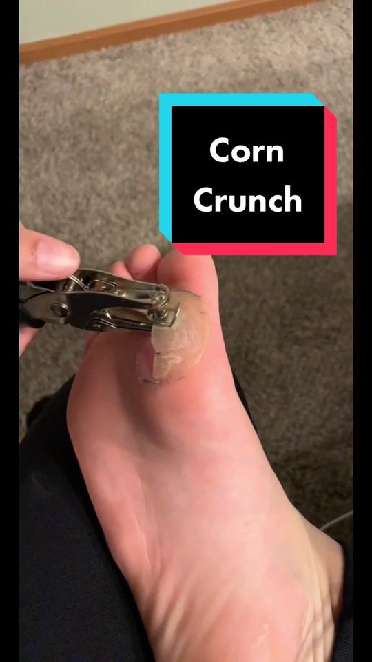 Video by Dr. Sandra Lee: with @lil_chingg always searching for new uses for OLD DEAD skin.
