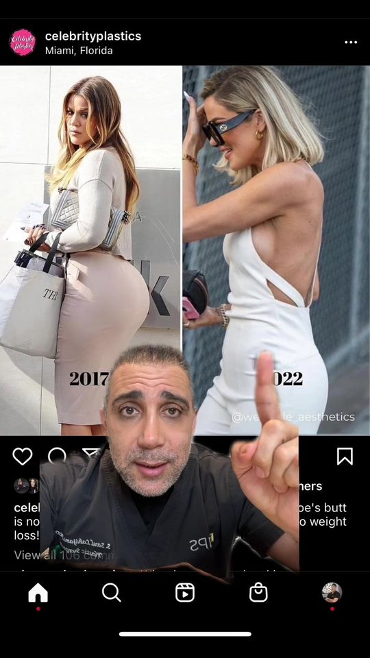 Video by Dr. Saul Lahijani: Did Khloe Kardashian get plastic surgery?