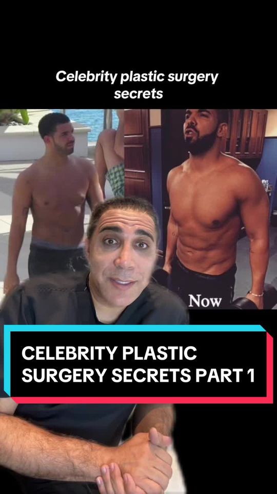 Video by Dr. Saul Lahijani: Celebrity plastic surgery secrets PART 1
