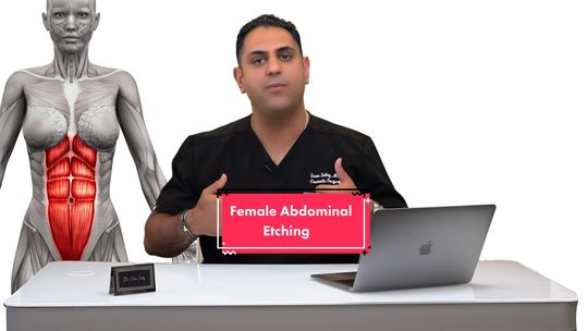 Video by Dr. Sean Satey: Female Abdominal Etching.