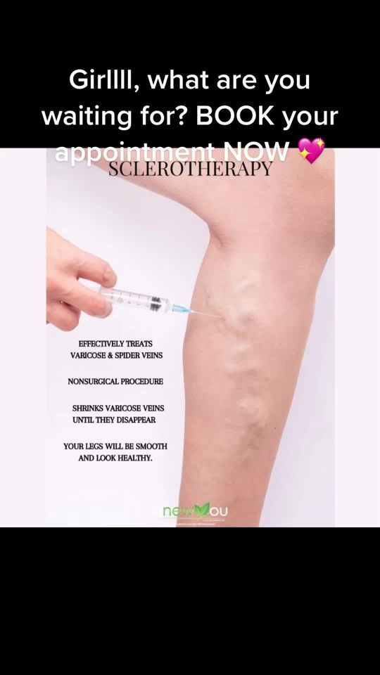 Video by Dr. Sherry Wehner: The best NON-INVASIVE solution for spider veins 🙌🏻✨