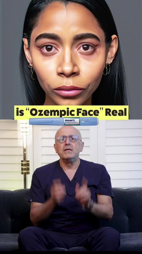 Video by Dr. Steven Batash: Mythbusting “Ozempic Face” Theory