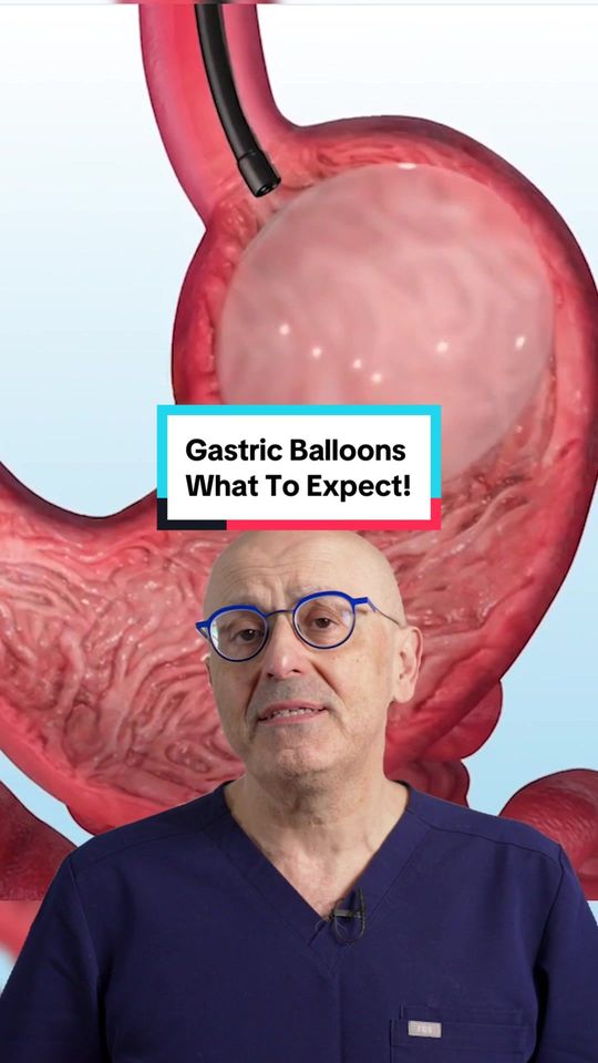 Video by Dr. Steven Batash: Gastric Balloons - What To Expect!