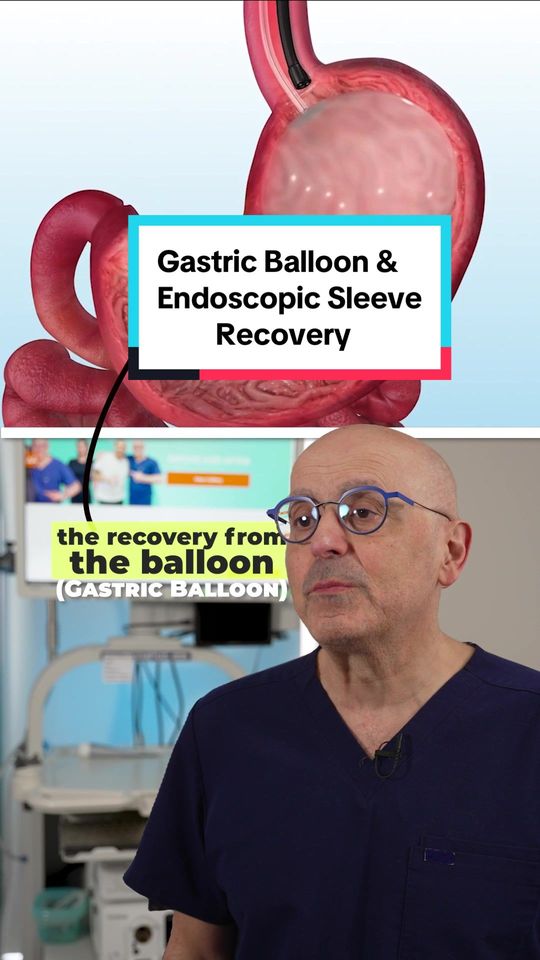 Video by Dr. Steven Batash: Gastric Balloon vs Endoscopic Sleeve Recovery!