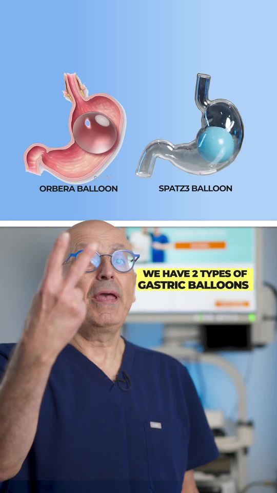 Video by Dr. Steven Batash: Two Different Types Of Gastric Balloons!