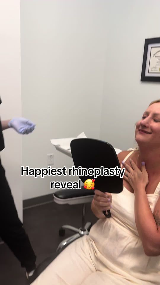 Video by Dr. Steven M. Camp: We LOVE what we do to help people feel their best. Only one week post-op after preservation Swell…