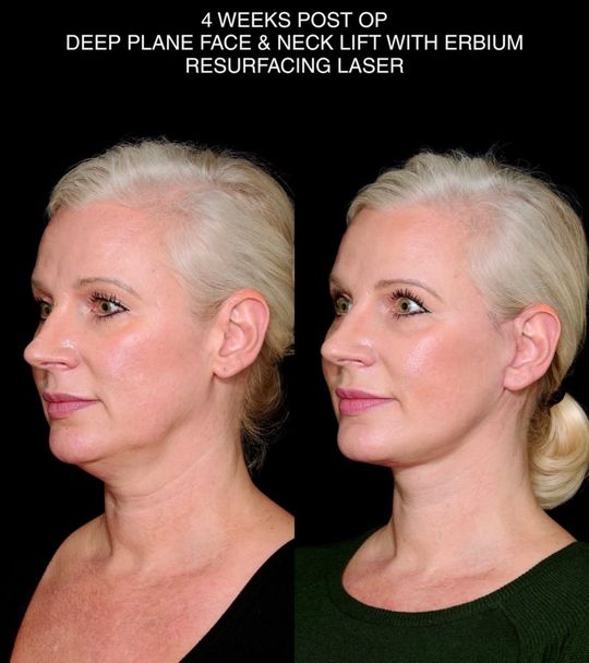 Video by Dr. Steven M. Camp: ✨ Treatment details: My signature treatment. If you know you know. This is quiet luxury 🌿 Skinca…