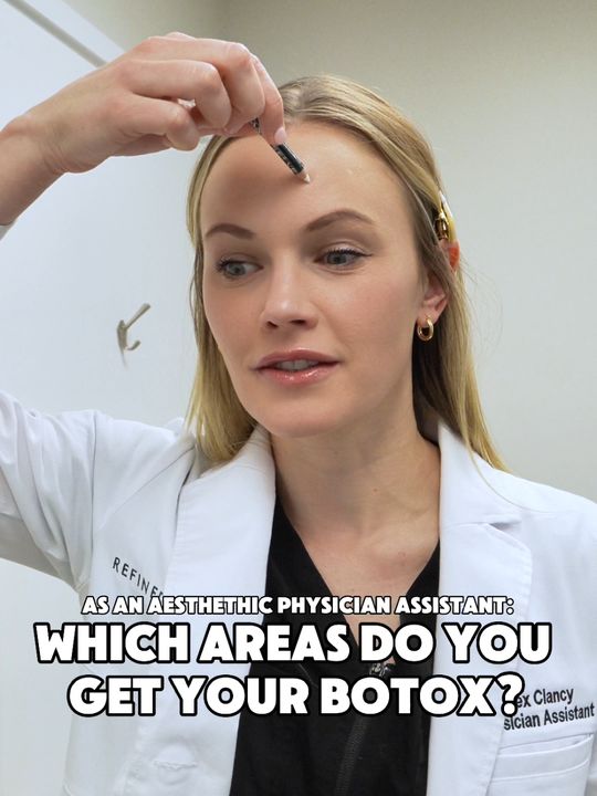 Video by Dr. Steven Swengel: As an aesthetic physicians assistant, which areas does Alex get botox? She talks about where she…