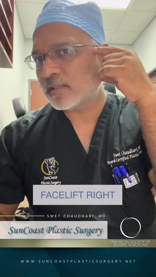Video by Dr. Swet Chaudhari: Today Dr. C is doing facelift on a 62 year old male. Watch and follow to see how’s it’s done! 🤩…