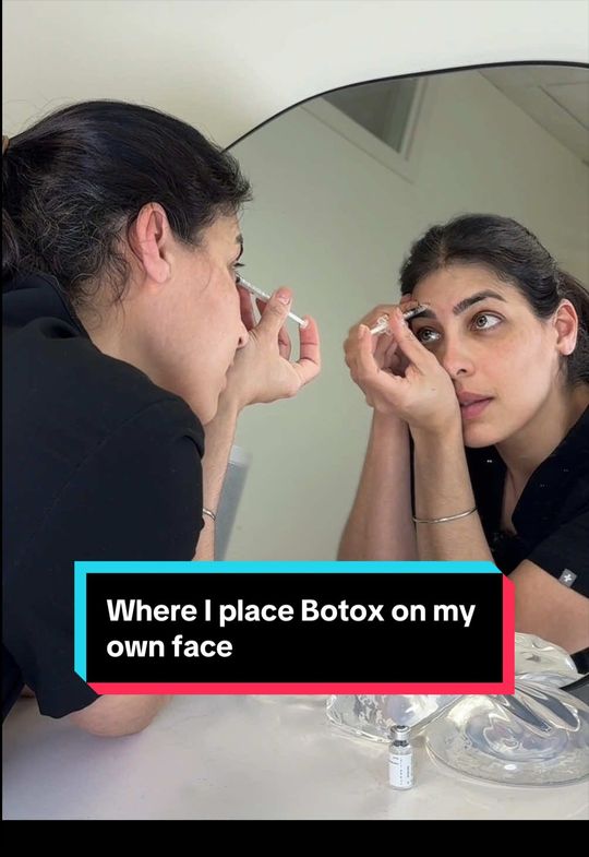 Video by Dr. Tanya Judge: Injecting my own Botox or Dysport, where I inject and how much I use for natural-looking results 💉