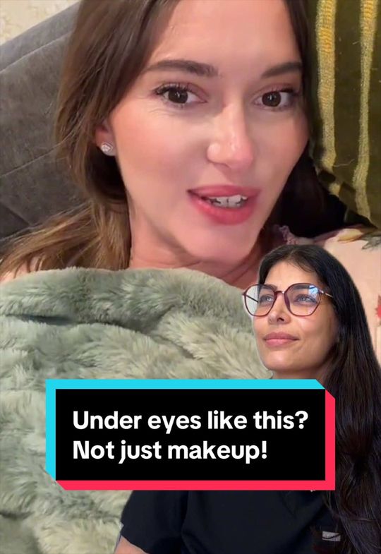 Video by Dr. Tanya Judge: Under eyes this bright and smooth often come down to structural change, not just concealer. Love…