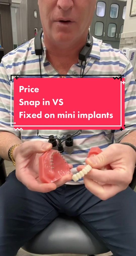 Video by Dr. Todd E. Shatkin: (10 mini implants)⏩ 9600 ⬆️7300⬇️🟰16.9K (22 )⏩18K⬆️18K⬇️🟰36K