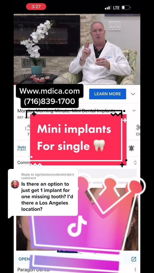 Video by Dr. Todd E. Shatkin: yes you can replace 1 🦷 with rather than a & place a Youtube channel has more info!