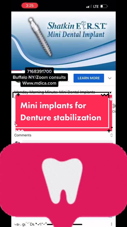 Video by Dr. Todd E. Shatkin: Loose dentures? No problem! We can convert traditional to using Also called a