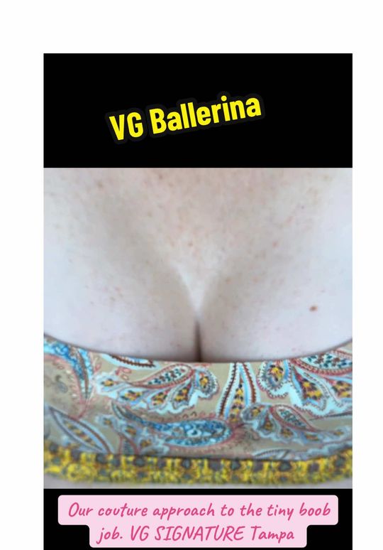 Video by Dr. Vipul Gargya: ✨ The VG Ballerina™ Breast - the art of balance, not volume. She didn’t want attention. She wante…