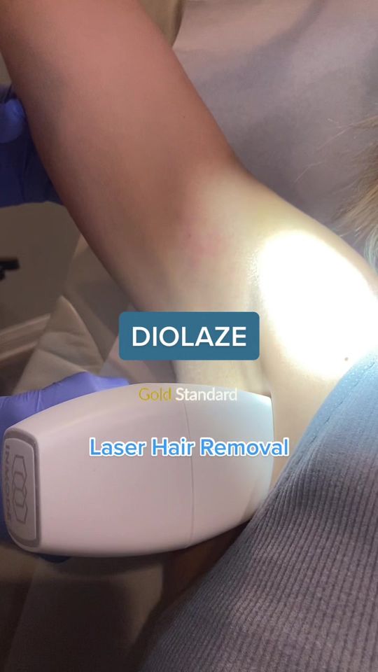 Video by Dr. Wesley G. Schooler: Underarm Laser 💥