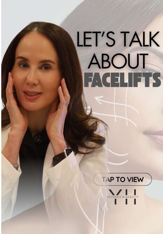 Video by Dr. Yael Halaas: Thinking about a facelift? Here’s what you need to know! ✅ Natural-looking results – No more “pul…
